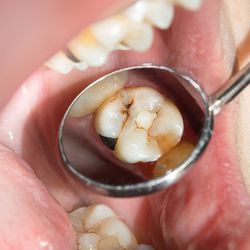 What’S The Difference Between These Dental Professionals?