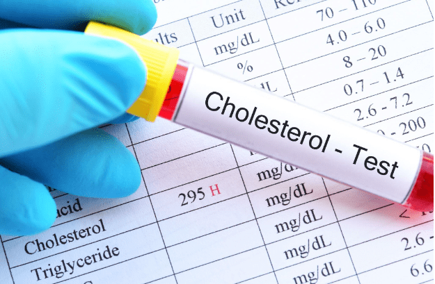 Cholesterol And Sleep Apnea