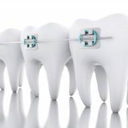 Don'T Do-It-Yourself When It Comes To Dentistry