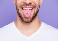Tongue Tie In Adults