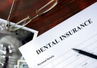 Why Keeping Dental Insurance Is Important