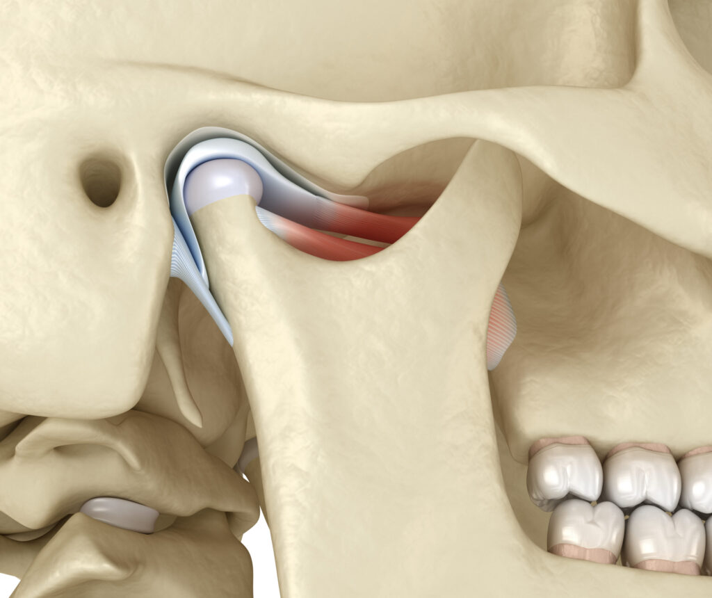 Telling the Difference Between TMJ and TMJD