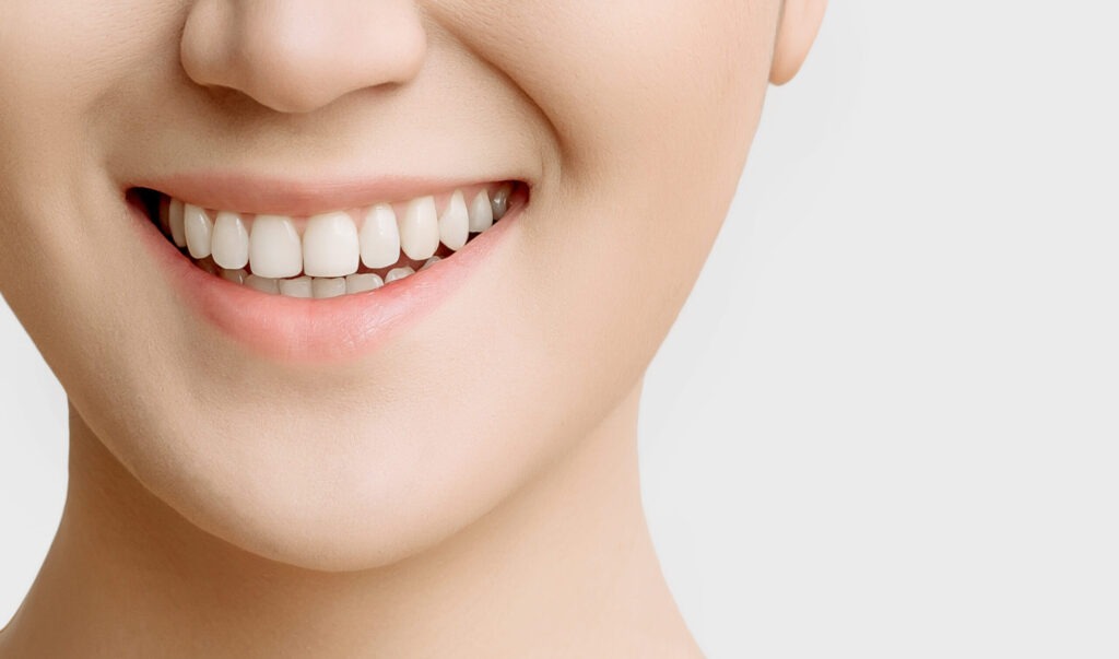 Should You Get Cosmetic Edge Bonding?