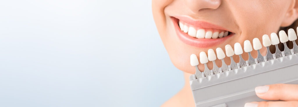Cosmetic Dentistry Options That Won’t Break The Bank
