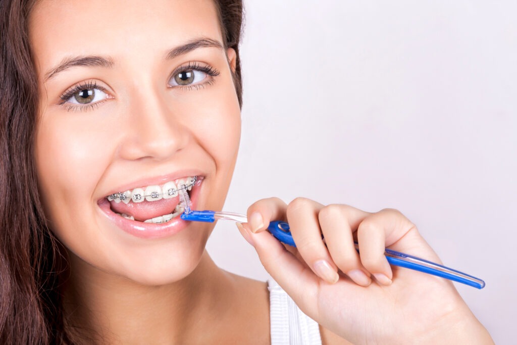 How To Prevent White Spots On Your Teeth During Orthodontic Treatment